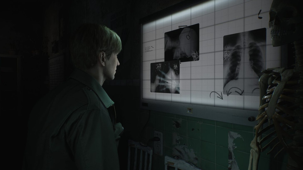 El CEO de Bloober Team espera que la campaña de marketing del remake de Silent Hill 2 arranque pronto